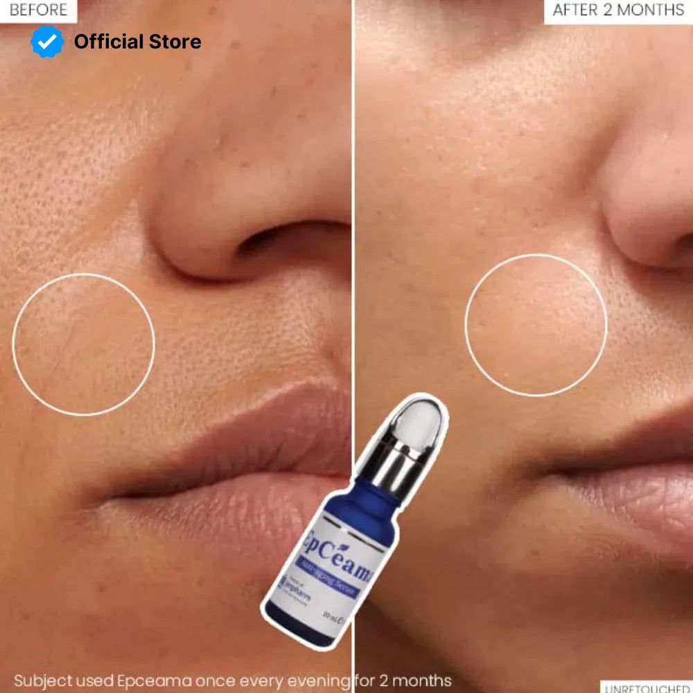 Jenpharm Epceama Anti Aging Serum