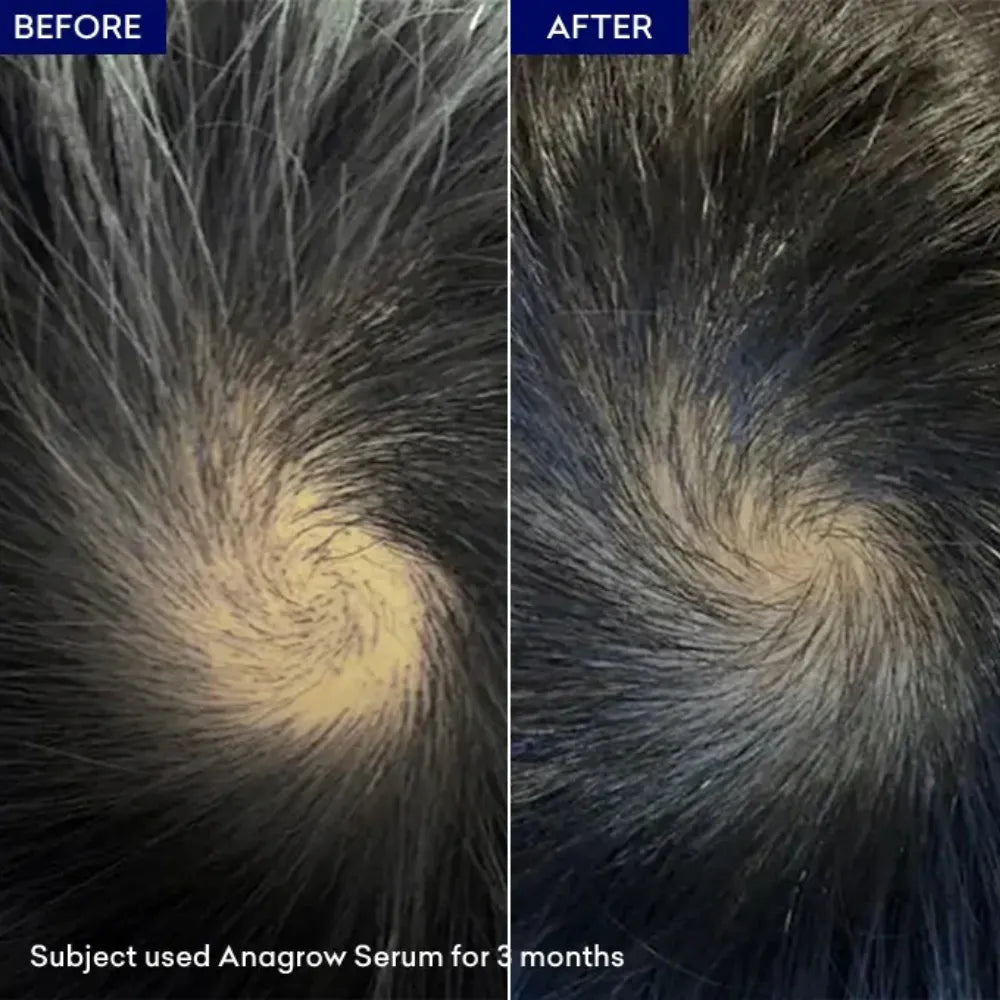 Jenpharm Anagrow Hair Serum