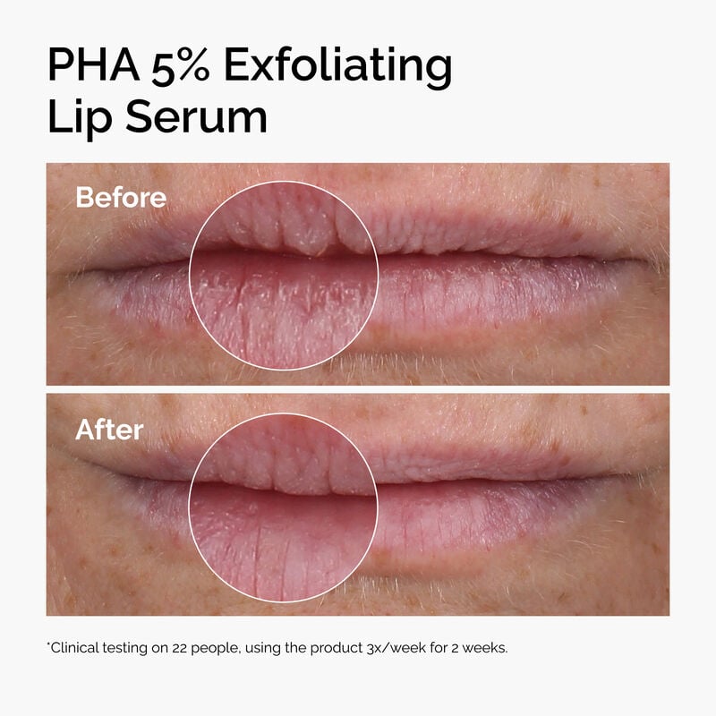 The Ordinary PHA 5% Exfoliating Lip Serum
