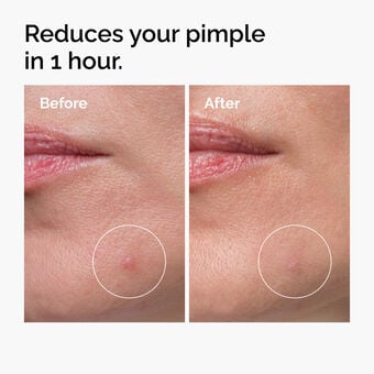 The Ordinary Sulfur 10% Powder-to-Cream Concentrate