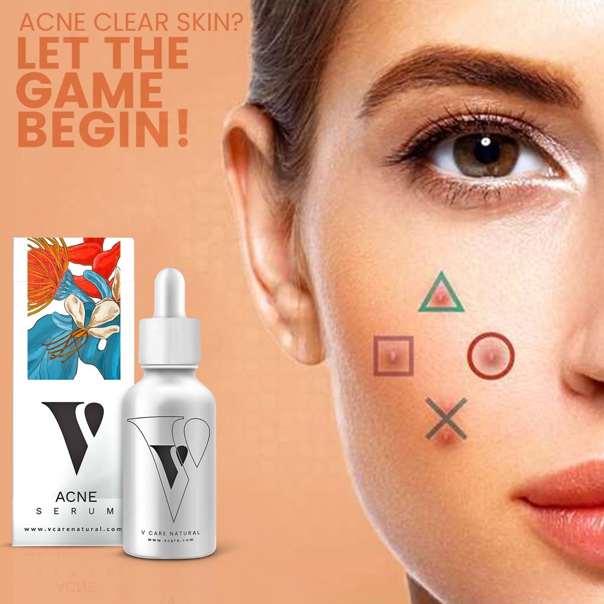 Acne Serum - Vcare Natural
